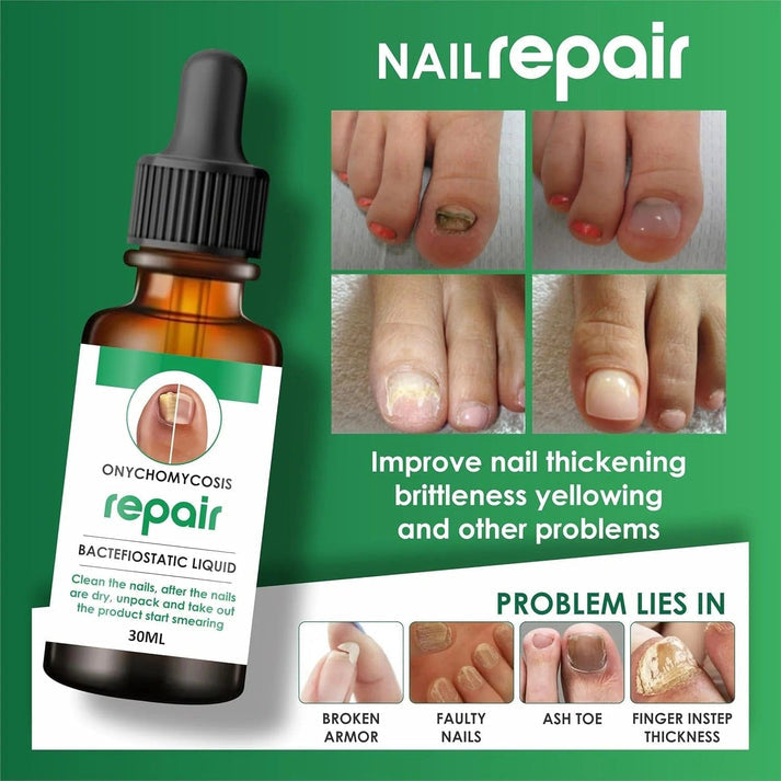 NailVeda™ Advanced Nail Growth & Repair Serum